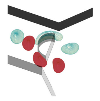 Imagen: Visualización de una simulación numérica de una célula fluyendo a través de un obstáculo, a través del dispositivo de micorfluidos (Imagen cortesía del KTH – Instituto Real de Tecnología).