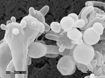 Imagen: Microfotografía electrónica de barrido (SEM) del hongo patógeno, Cryptococcus gattii (Fotografía cortesía de Edmond Byrnes / Joseph Heitman).
