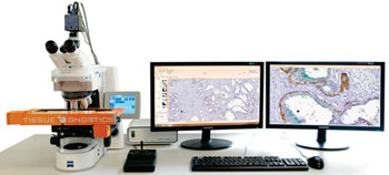 Imagen: Un sistema de análisis microscópico captura automáticamente hasta ocho láminas con cortes coloreados por inmunohistoquímica y realiza el análisis cuantitativo de las intensidades de coloración (Fotografía cortesía de TissueGnostics).