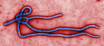Imagen: Microfotografía electrónica de transmisión en color (TEM) revelando un poco de la morfología ultraestructural del virión del virus del Ébola (Imagen cortesía de Cynthia Goldsmith / CDC).