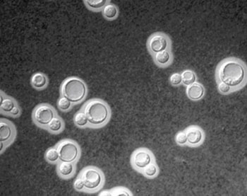 Imagen B: Células levaduriformes de Cryptococcus neoformans Fotografía cortesía de la revista, Journal of Undergraduate Biological Studies).