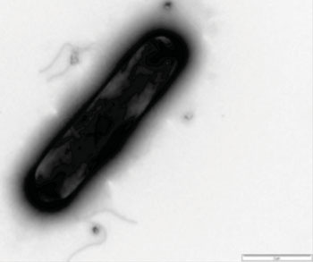 Imagen A: Foromicrografía de Clostridium difficile (Fotografía cortesía de la Universidad de Leicester).