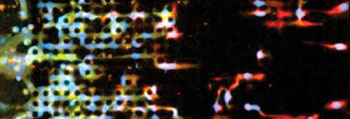 Imagen A: El dispositivo de microfluidos: a medida que las células que hacen la transición epitelial-mesenquimal, se mueven de izquierda a derecha a través del chip EMT; aquellas que expresan los marcadores mesenquimatosos (rojos) se desprenden y se mueven independientemente de las otras células, mientras que las células que expresan los marcadores epiteliales (verdes) continúan moviéndose  como un frente colectivo (Fotografía cortesía del Hospital General de Massachusetts).