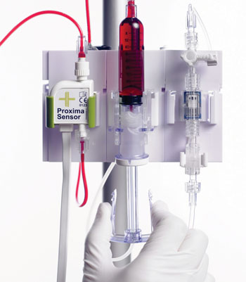 Imagen B: El sensor, miniaturizado, Proxima, ha sido integrado en la línea arterial del paciente, con el fin de ser usado para la monitorización directa de los gases sanguíneos y los electrolitos, durante un período de 72 horas, tantas veces como es necesario (Fotografía cortesía de Sphere Medical).