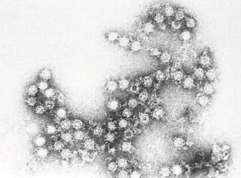 Imagen: Una microfotografía electrónica de transmisión (TEM) revela algo de la morfología ultraestructural exhibida por un agrupamiento de viriones de Enterovirus (Fotografía del CDC).