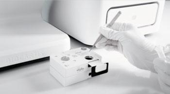 Imagen: El Idylla es un sistema de diagnóstico molecular para PCR en tiempo real, totalmente automatizado, diseñado para analizar una amplia variedad de tipos de muestras clínicas (Fotografía cortesía de Biocartis).