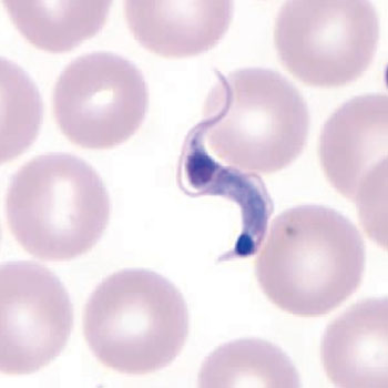 Imagen: El Trypanosoma cruzi, el parásito causante de la enfermedad de Chagas en un frotis de sangre (Fotografía cortesía del CDC).