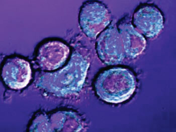Imagen: Los NanoDestellos son células madre, diseñadas especialmente, que han sido desarrolladas para detectar cánceres transportados en la sangre. Cuando las células entran en contacto con las células cancerosas emiten luz (Fotografía cortesía del Instituto Internacional para Nanotecnología en la Universidad Northwestern).