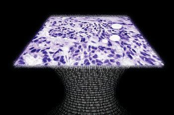 Imagen: Una muestra de tejido creada por el microscopio sin lentes (Fotografía cortesía del Prof. Aydogan Ozcan).