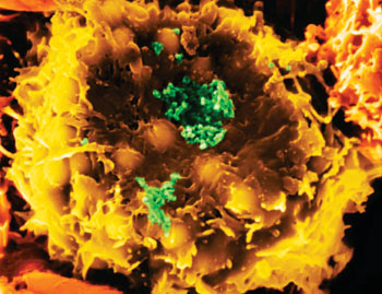 Imagen: Microfotografía electrónica de barrido (SEM) del virus linfotrópico de célula-T humanas-1(HTLV-1) (verde), infectando un linfocito-T (amarillo) (Fotografía cortesía del Dr. Dennis Kunkel).
