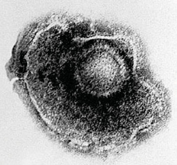 Imagen: Microfotografía electrónica de transmisión (TEM) del virus Varicella zoster (Fotografía cortesía del Dr. Erskine Palmer).