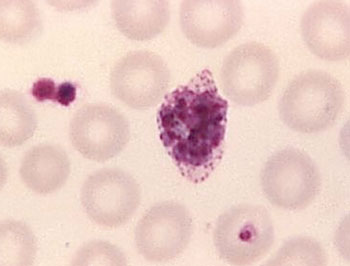 Imagen: Un trofozoito maduro de Plasmodium ovale en un extendido de sangre (Fotografía cortesía de los CDC).