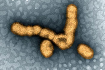 Imagen: Microfotografía electrónica de transmisión (TEM) a color que muestra las partículas del virus de la influenza H1N1 (Fotografía cortesía del Instituto Nacional de Alergias y Enfermedades Infecciosas de los EUA).