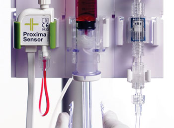 Imagen B: El Sensor miniatura Próxima está integrado a la línea arterial de un paciente para ser utilizado directamente para el control de los gases sanguíneos y los electrolitos durante un período de 72 horas, tantas veces como sea necesario (Fotografía cortesía de Sphere Medical).