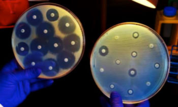 Imagen: La placa de la derecha fue inoculada con una Enterobacteria  resistente al Carbapenem (CRE) que resultó ser resistente a todos los antibióticos ensayados; las bacterias en la placa izquierda son susceptibles a los antibióticos en los discos (Fotografía cortesía de James Gathany).