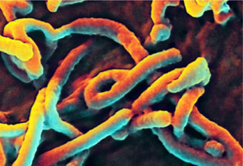 Imagen: Una micrografía electrónica de barrido (SEM), coloreada digitalmente, de partículas filamentosas del virus del Ébola en gemación (Fotografía cortesía del Instituto Nacional de Alergias y Enfermedades Infecciosas).