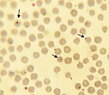 Imagen B: Anaplasma ovis en un frotis de sangre de una oveja infestada (Institutos Nacionales de la Salud de los EUA).