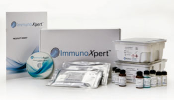 Imagen: La prueba ImmunoXpert diferencia con exactitud entre las infecciones bacterianas y virales (Fotografía cortesía de MeMed).