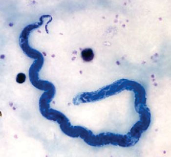 Imagen B: Unas microfilarias de Loa loa en una gota gruesa (Fotografía cortesía de la Universidad de Wisconsin-La Crosse).
