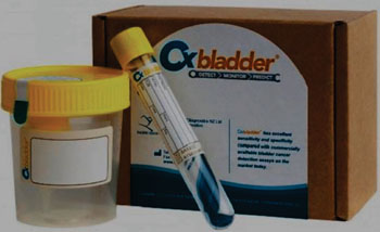 Imagen: El kit Cxbladder, diseñado como una prueba de laboratorio no invasiva para la detección del cáncer de vejiga (Fotografía cortesía de Peter Wren-Hilton).