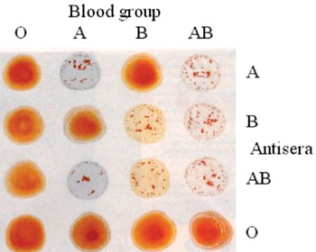 Imagen: Prueba de hemaglutinación de glóbulos rojos, utilizada para clasificar los grupos sanguíneos ABO (Fotografía cortesía del Colegio Universitario de Londres).