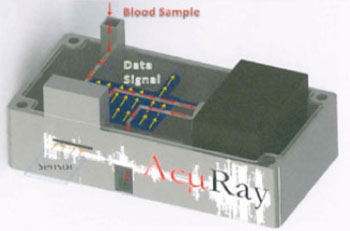 Imagen: Un modelo prototipo del dispositivo de diagnóstico AcμRay para los puntos de atención (Fotografía cortesía de la Universidad de Emory).