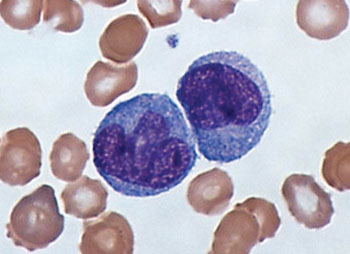 Imagen: Un frotis de sangre coloreado con Giemsa mostrando monocitos (Fotografía cortesía del Dr. Graham Beards).