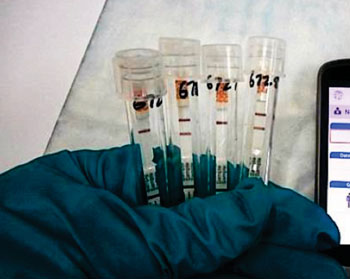Imagen: La Prueba Rápida de Antígeno ReEBOV para la infección viral del Ébola (Fotografía cortesía de Corgenix).