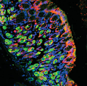 Imagen: Imagen de inmunofluorescencia de un corte de estómago humano teñido que muestra la ARHGAP26 (verde), la cadherina epitelial (rojo) y los núcleos celulares (azul). La cadherina epitelial está presente en todos los tipos de células epiteliales del estómago, mientras que la ARHGAP26 está restringida a las células parietales (Fotografía cortesía de Instituto del Genoma de ASTAR de Singapur).