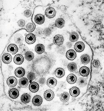Imagen B: Una micrografía electrónica de transmisión (TEM) de numerosos viriones de herpes simplex, miembros de la familia de virus Herpesviridae (Fotografía cortesía del Dr. Fred Murphy y Sylvia Whitfield).