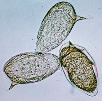 Imagen A: Unos huevos de Schistosoma mansoni en un montaje húmedo sin colorear (Fotografía cortesía de los CDC).