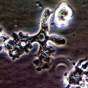 Imagen A: Una microfotografía de trofozoito Balamuthia mandrillaris en cultivo (Fotografía cortesía del CDC).
