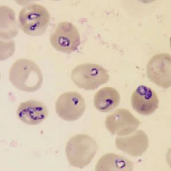Imagen: Una microfotografía de tun frotis de sangre coloreado con Giemsa mostrando organismos de Babesia incluidos en los eritrocitos (Fotografía cortesía del CDC).