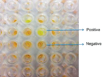 Imagen A: Una visualización de una reacción de amplificación isotérmica mediada por bucle (LAMP) en un formato de placa de 96 pozos que muestra diferencias de color entre las muestras positivas y negativas (Foto cortesía de la Unidad de Consejo de Investigación Médica, Gambia).