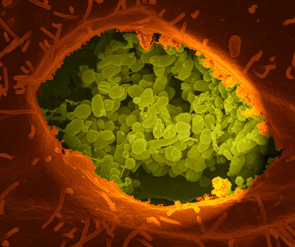 Imagen: Una fractura en seco de una célula Vero exponiendo el contenido de una vacuola donde la Coxiella burnetii, el agente causante de la fiebre Q, está creciendo rápidamente (Fotografía cortesía de los Institutos Nacionales de Salud).