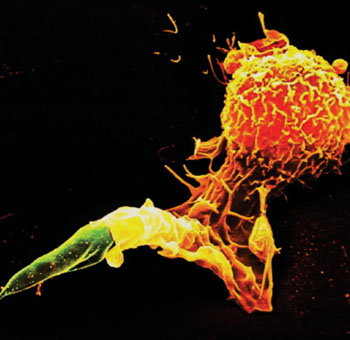 Imagen B: Microfotografía electrónica de barrido de un tipo de glóbulo blanco, un macrófago, envolviendo un promastigote de Leishmania (Fotografía cortesía de Juergen Berger).
