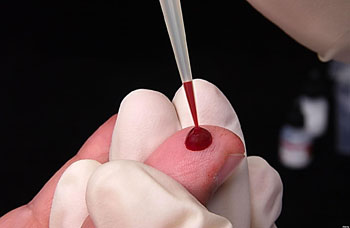 Imagen: La sangre obtenida mediante punción digital se utiliza comúnmente en los ensayos para los puntos de atención (Fotografía cortesía de The Health).