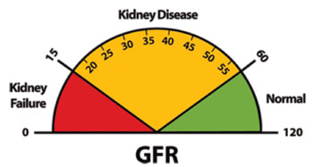 Imagen: La calculadora de la tasa de filtración glomerular utilizada para calcular la enfermedad renal crónica (Fotografía cortesía del Instituto Nacional de Diabetes y de Enfermedades Digestivas y del Riñón).