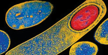 Imagen: Una micrografía electrónica de transmisión a color (TEM) de Clostridium difficile formando una endospora (rojo) (Fotografía cortesía del Dr. J. Thomas Lamont).