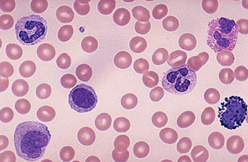 Imagen: Una microfotografía de un frotis de sangre mostrando varios leucocitos como parte de un recuento diferencial (Fotografía cortesía de la Universidad de Utah).