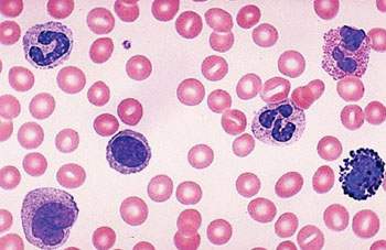 Imagen B: Fotomicrografía de un frotis de sangre, parte del recuento sanguíneo completo (hemograma) (Fotografía cortesía del Centro Medico de la Universidad de Utah).