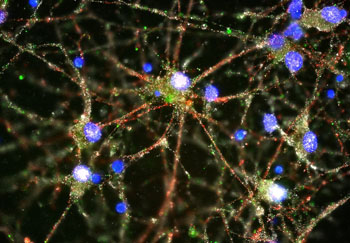 Imagen A: Micrografía del experimento de imagenología que muestra la molécula de C4 (verde) localizada en las sinapsis (rojo y blanco) de las neuronas humanas en cultivo primario (cuerpos celulares en azul) (Fotografía cortesía de Heather de Rivera, Laboratorio McCarroll).