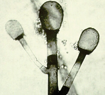 Imagen A: Esporangióforos, columelas y rizoides primitivas de Rhizomucor spp, el hongo zigomiceto detectado por el PathoChip, un array que tiene la capacidad de detectar todos los virus conocidos, así como una gran variedad de bacterias, hongos, helmintos y protozoos (Fotografía cortesía de. la Universidad de Adelaida).