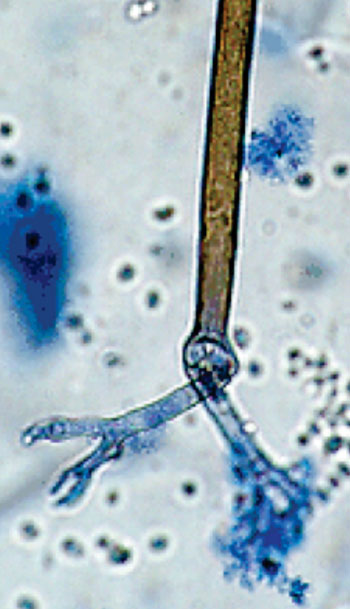Imagen B: Rhizomucor pusillus (Fotografía cortesía de la Universidad de Adelaida).