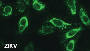 Imagen: Análisis de inmunofluorescencia indirecta (IFI) de las células infectadas con el virus Zika (Fotografía cortesía de EUROIMMUN ).