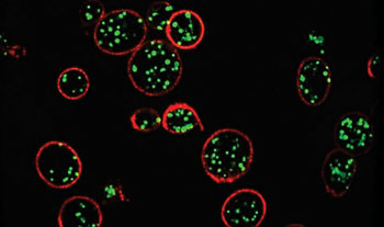 Imagen: Gránulos de las plaquetas en una muestra de sangre coloreada para la proteína marcadora CD63 visualizada mediante Microscopía de Iluminación Estructurada (Fotografía cortesía del Colegio Universitario de Londres).