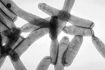 Imagen B: Una microfotografía electrónica de transmisión (TEM) de Legionella pneumophila, la bacteria responsable de más del 90% de los casos de la enfermedad del legionario (Fotografía cortesía del CDC).