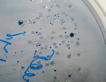 Imagen: Colonias de Streptococcus mutans creciendo en agar Mitis Salivarius con bacitracina mostrando colonias convexas, de azul pálido, con apariencia de vidrio esmerilado granular (Fotografía cortesía de los Dres. Rajan y Shivani Dhawan).