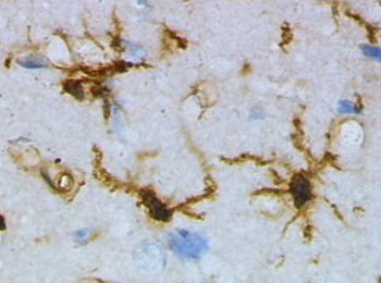Imagen: Una micrografía de las células microgliales, que expresan selectivamente la proteína TREM2 (Fotografía cortesía de Wikimedia Commons).