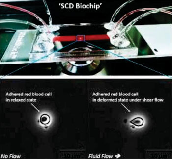 Imagen A: El sistema de microfluidos SCD biochip para el sondeo de la deformación dinámica y la adhesión de los eritrocitos en la sangre (glóbulos rojos) en muestras de sangre de pacientes con enfermedad de células falciformes (ECF) (Fotografía cortesía de la Universidad Case Western Reserve).